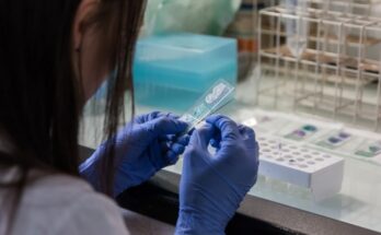 Cómo bajar la tensión rápidamente de forma natural