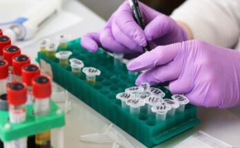 ¿Cómo se contagia la meningitis B?